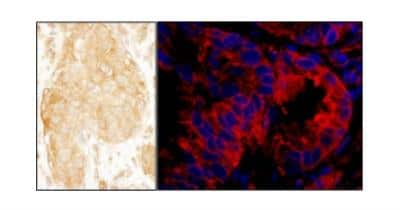 Immunohistochemistry: SASH1 Antibody [NBP1-26651]