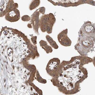 Immunohistochemistry-Paraffin: SASH1 Antibody [NBP1-85182]