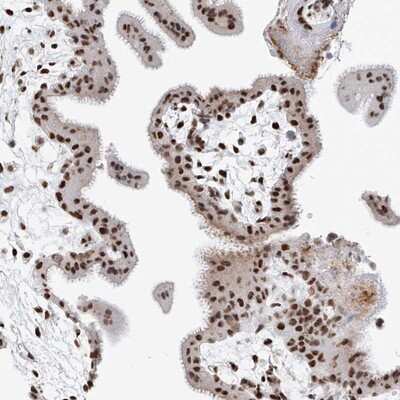 Immunohistochemistry-Paraffin: SASH1 Antibody [NBP1-85183]
