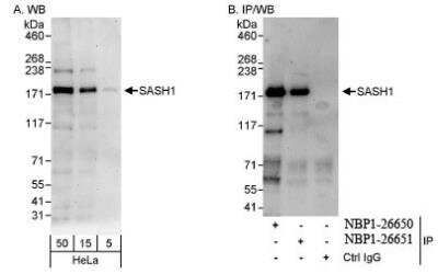 Western Blot: SASH1 Antibody [NBP1-26650]