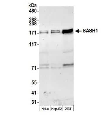 Western Blot: SASH1 Antibody [NBP1-26650]