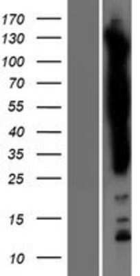 Western Blot: SASH1 Overexpression Lysate [NBP2-07196]