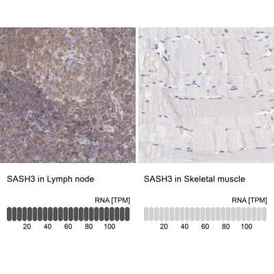 Immunohistochemistry-Paraffin: SASH3 Antibody [NBP1-92364]