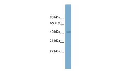 Western Blot: SASH3 Antibody [NBP2-85687]