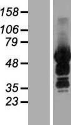 Western Blot: SASH3 Overexpression Lysate [NBL1-15697]