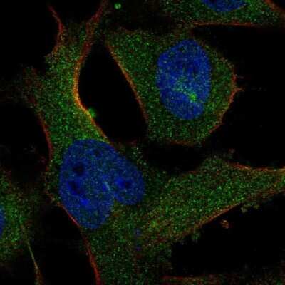 Immunocytochemistry/ Immunofluorescence: SASS6 Antibody [NBP1-85043]