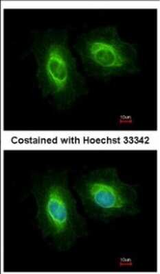 Immunocytochemistry/ Immunofluorescence: SASS6 Antibody [NBP2-20264]
