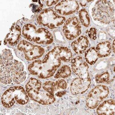 Immunohistochemistry-Paraffin: SASS6 Antibody [NBP1-85043]