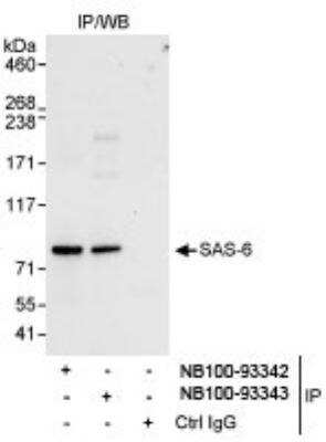 Immunoprecipitation: SASS6 Antibody [NB100-93342]