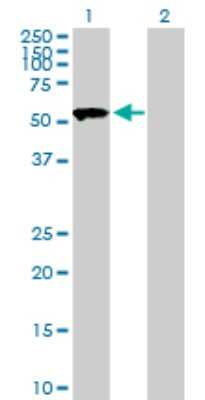 Western Blot: SASS6 Antibody [H00163786-B01P]