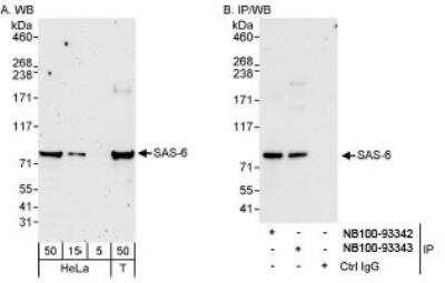 Western Blot: SASS6 Antibody [NB100-93343]