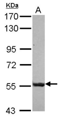 Western Blot: SASS6 Antibody [NBP2-20264]