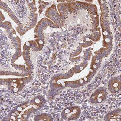 Immunohistochemistry-Paraffin: SAT1 Antibody [NBP2-37947]