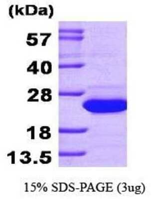 SDS-PAGE: Recombinant Human SAT1 His Protein [NBP1-30198]