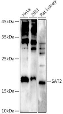 Western Blot: SAT2 AntibodyBSA Free [NBP3-04471]