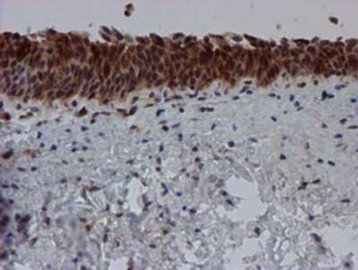 Immunohistochemistry-Paraffin: SAT2 Antibody (OTI1C9) [NBP2-01998]