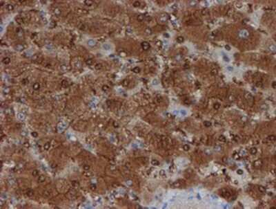 Immunohistochemistry-Paraffin: SAT2 Antibody (OTI1C9) [NBP2-01998]