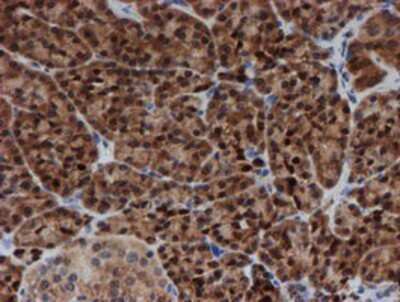 Immunohistochemistry-Paraffin: SAT2 Antibody (OTI1C9) [NBP2-01998]
