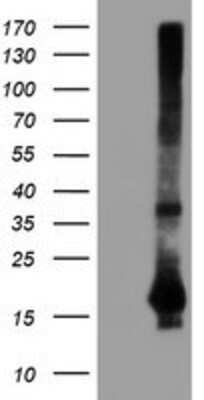 Western Blot: SAT2 Antibody (OTI1C9) [NBP2-01998]