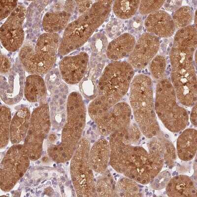 Immunohistochemistry: SAT2 Antibody [NBP2-49244]