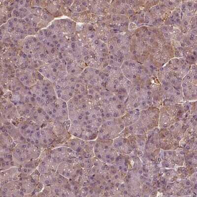 Immunohistochemistry-Paraffin: SAT2 Antibody [NBP1-80722]