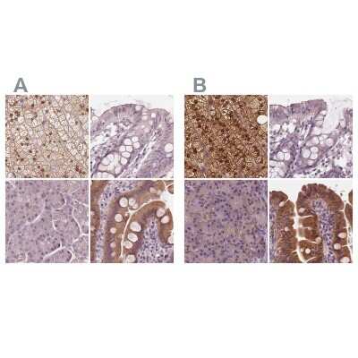 Immunohistochemistry-Paraffin: SAT2 Antibody [NBP2-49244]