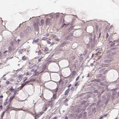 Immunohistochemistry-Paraffin: SAT2 Antibody [NBP2-49244]