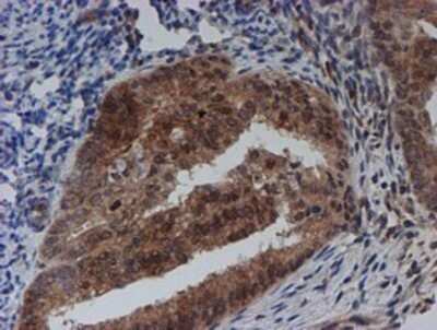 Immunohistochemistry: SAT2 Antibody (OTI1C9) - Azide and BSA Free [NBP2-73990]