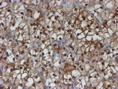 Immunohistochemistry: SAT2 Antibody (OTI1C9) - Azide and BSA Free [NBP2-73990]