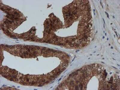 Immunohistochemistry: SAT2 Antibody (OTI1C9) - Azide and BSA Free [NBP2-73990]