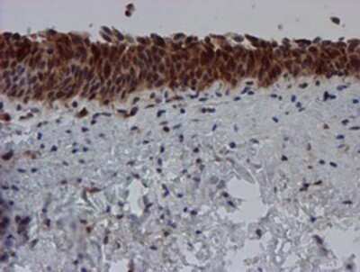 Immunohistochemistry: SAT2 Antibody (OTI1C9) - Azide and BSA Free [NBP2-73990]