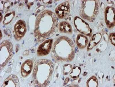 Immunohistochemistry: SAT2 Antibody (OTI1C9) - Azide and BSA Free [NBP2-73990]