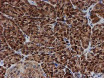 Immunohistochemistry: SAT2 Antibody (OTI1C9) - Azide and BSA Free [NBP2-73990]