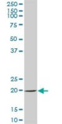 Western Blot: SAT2 Antibody [H00112483-B01P]