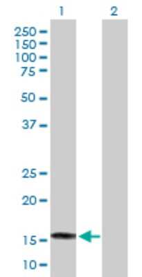 Western Blot: SAT2 Antibody [H00112483-B01P]