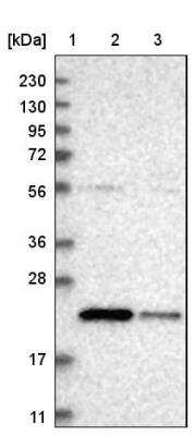 Western Blot: SAT2 Antibody [NBP1-80722]