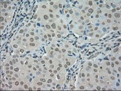 Immunohistochemistry-Paraffin: SATB1 Antibody (OTI13D6) [NBP1-47950]