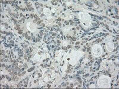 Immunohistochemistry-Paraffin: SATB1 Antibody (OTI13D6) [NBP1-47950]