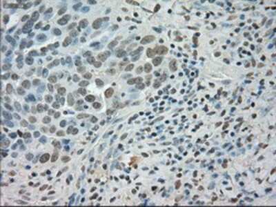 Immunohistochemistry-Paraffin: SATB1 Antibody (OTI13D6) [NBP1-47950]