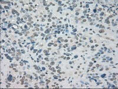 Immunohistochemistry-Paraffin: SATB1 Antibody (OTI13D6) [NBP1-47950]