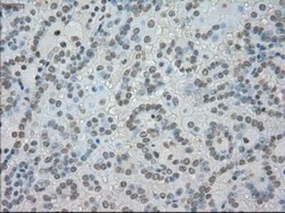Immunohistochemistry-Paraffin: SATB1 Antibody (OTI13D6) [NBP1-47950]