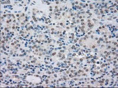 Immunohistochemistry-Paraffin: SATB1 Antibody (OTI13D6) [NBP1-47950]