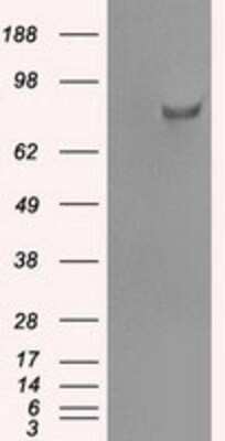 Western Blot: SATB1 Antibody (OTI13D6) [NBP1-47950]