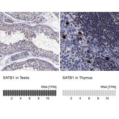 Immunocytochemistry/ Immunofluorescence: SATB1 Antibody [NBP3-17001]