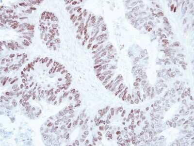 Immunohistochemistry-Paraffin: SATB1 Antibody [NBP2-15107]