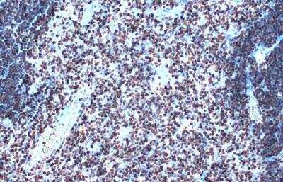 Immunohistochemistry-Paraffin: SATB1 Antibody [NBP2-15107]
