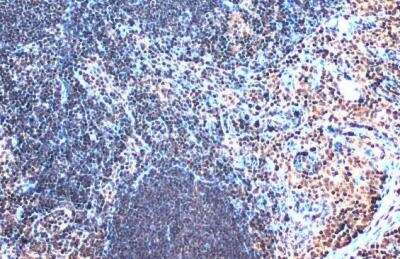 Immunohistochemistry-Paraffin: SATB1 Antibody [NBP2-15107]