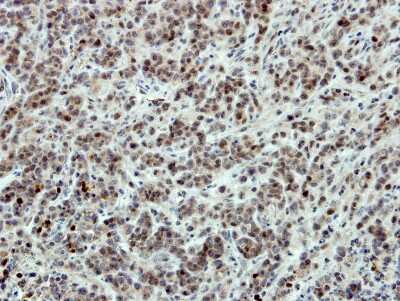 Immunohistochemistry-Paraffin: SATB1 Antibody [NBP2-15108]