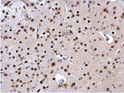 Immunohistochemistry-Paraffin: SATB1 Antibody [NBP2-15108]