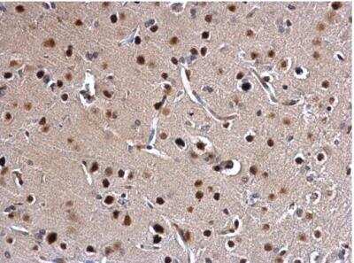 Immunohistochemistry-Paraffin: SATB1 Antibody [NBP2-15108]